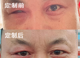 经典案例