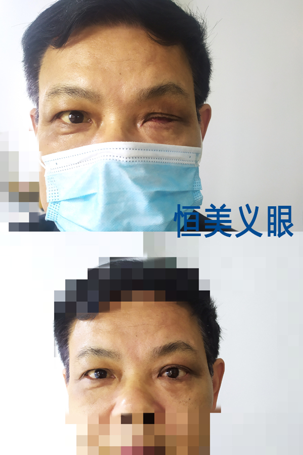 案例1-1.jpg
