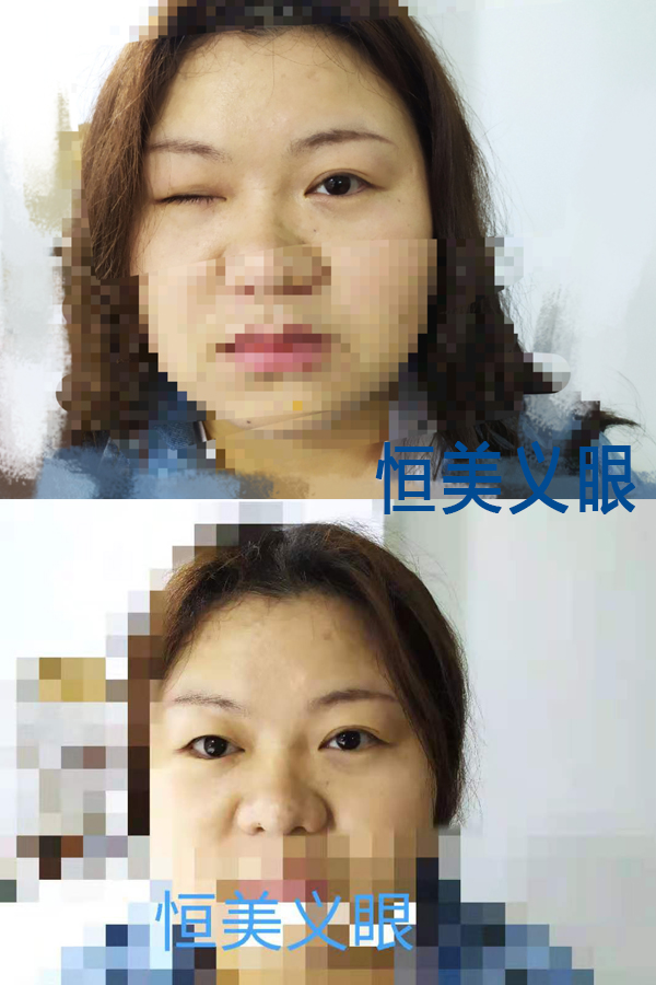 案例1-1.jpg