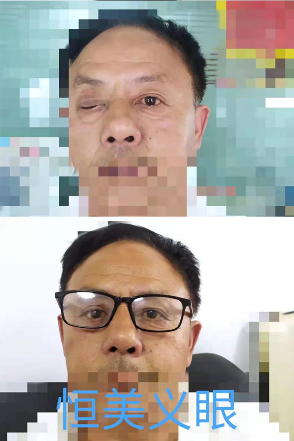 案例1-1.jpg