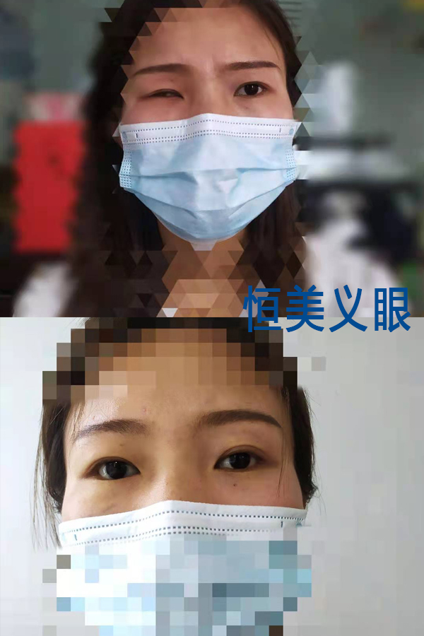 案例1-1.jpg